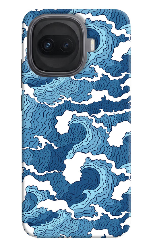 Blue Waves iQOO 15R 5G Hard Case Back Cover by Casekaro