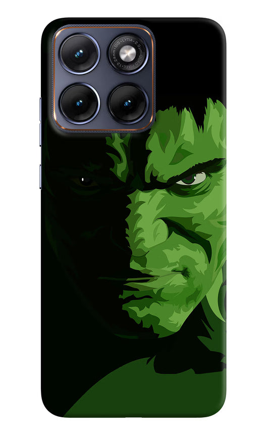 HULK Moto Edge 70 Fusion Hard Case Back Cover by Casekaro