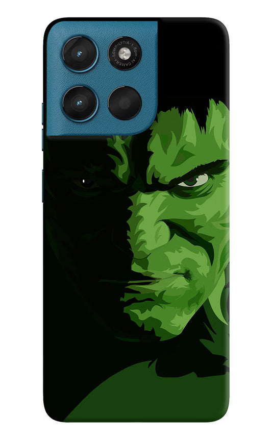 HULK Moto G57 Power 5G Hard Case Back Cover by Casekaro