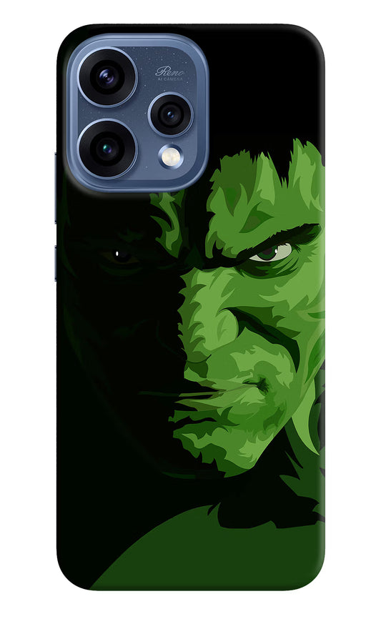 HULK Oppo Reno15 5G Hard Case Back Cover by Casekaro