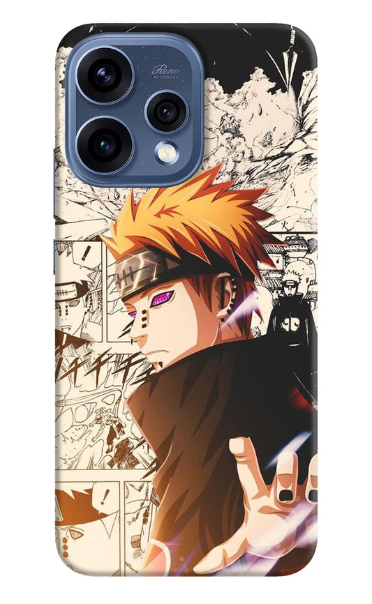 Pain Anime Oppo Reno15 5G Hard Case Back Cover by Casekaro