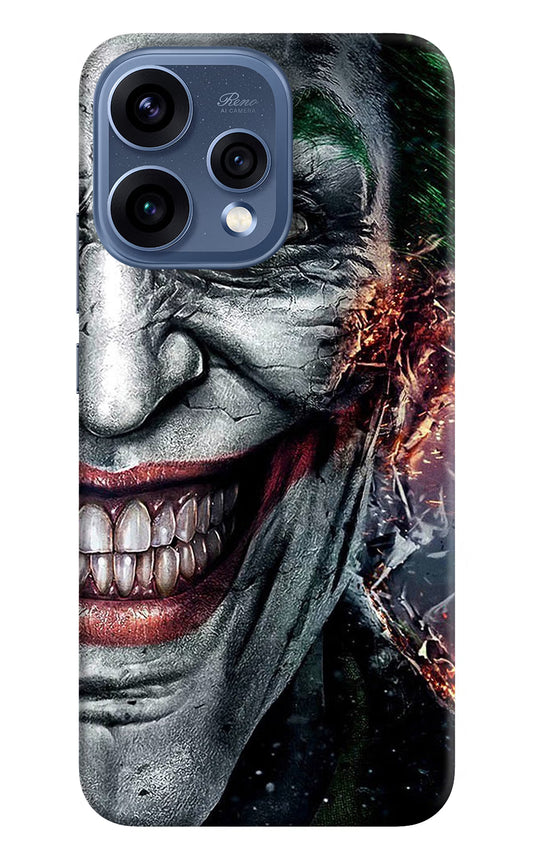 Joker Cam Oppo Reno15 5G Hard Case Back Cover by Casekaro