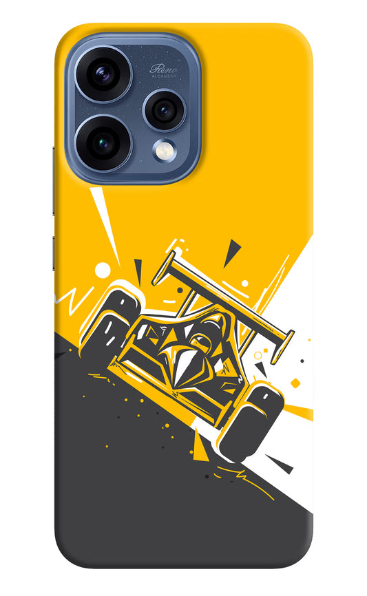 Track King Oppo Reno15 5G Hard Case Back Cover by Casekaro