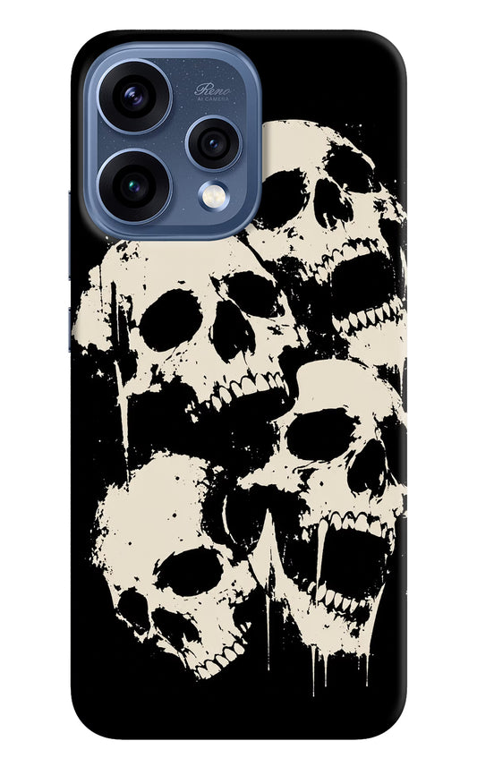 Dead Stack Oppo Reno15 5G Hard Case Back Cover by Casekaro