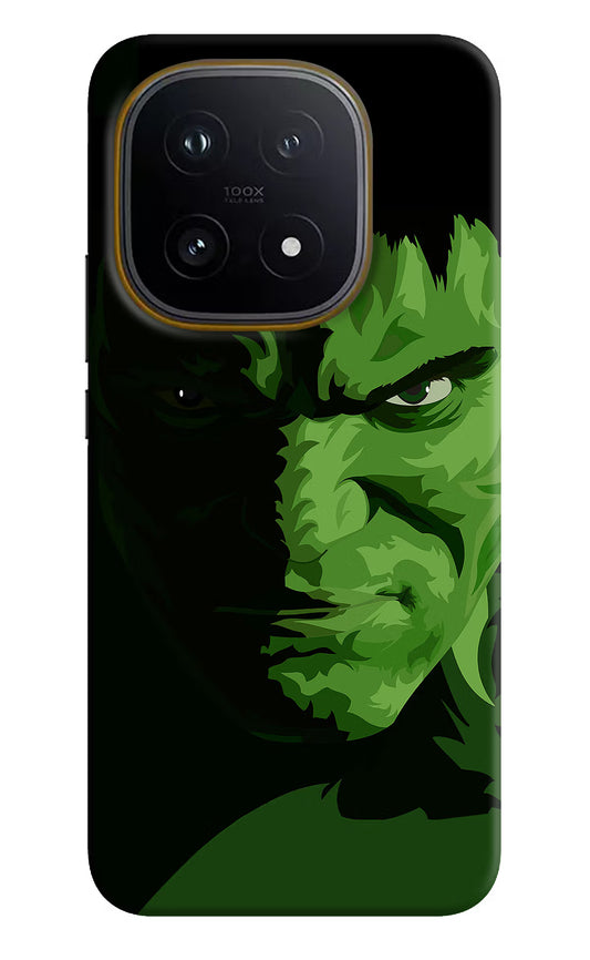 HULK iQOO 15 5G Hard Case Back Cover by Casekaro