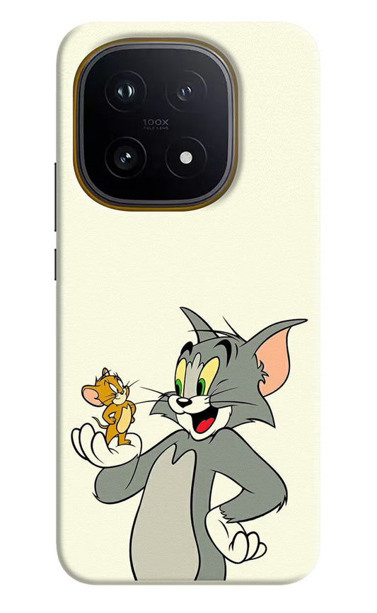 Tom & Jerry iQOO 15 5G Hard Case Back Cover by Casekaro