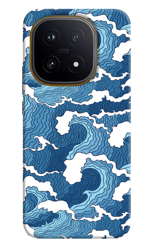 Blue Waves iQOO 15 5G Hard Case Back Cover by Casekaro