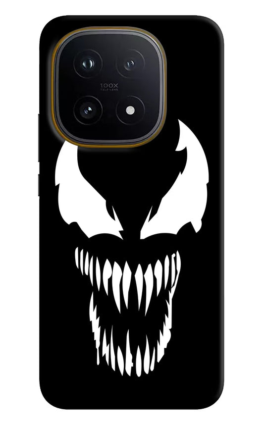 Venom iQOO 15 5G Hard Case Back Cover by Casekaro