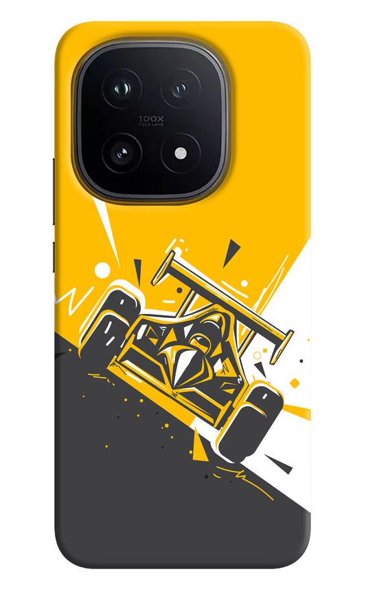 Track King iQOO 15 5G Hard Case Back Cover by Casekaro