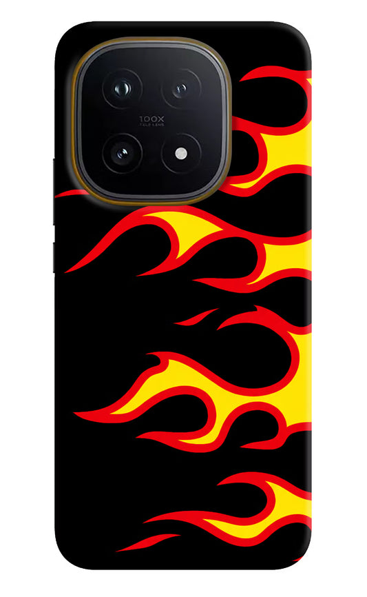 Side Sweep Flames iQOO 15 5G Hard Case Back Cover by Casekaro