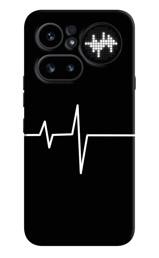 Heart Beats Nothing Phone 4a Pro Hard Case Back Cover by Casekaro