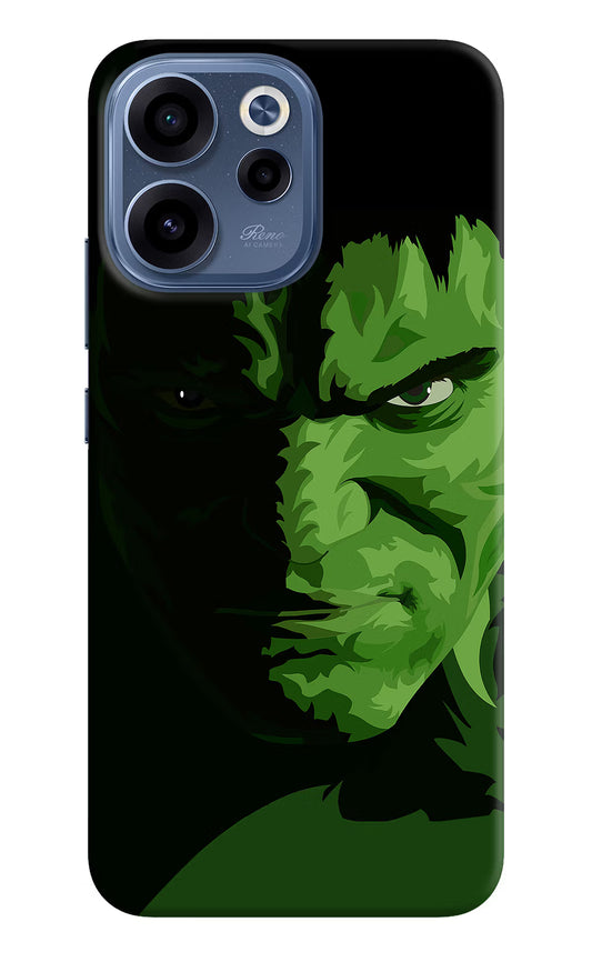HULK Oppo Reno15c 5G Back Cover