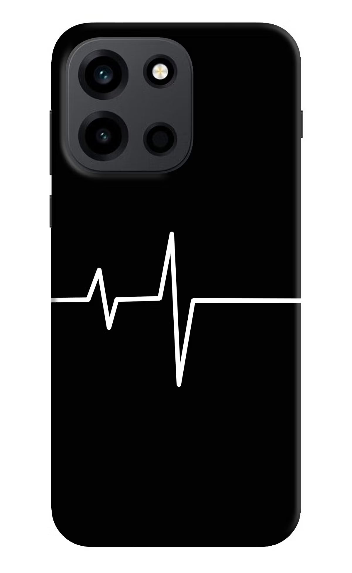 Heart Beats OnePlus Nord 6 Back Cover
