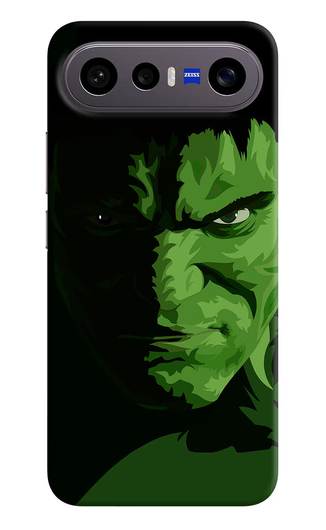 HULK Vivo X300 FE 5G Hard Case Back Cover by Casekaro