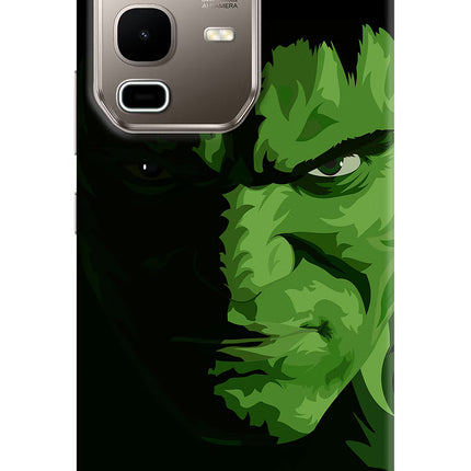 HULK Infinix Note 50s 5G Plus Hard Case Back Cover by Casekaro