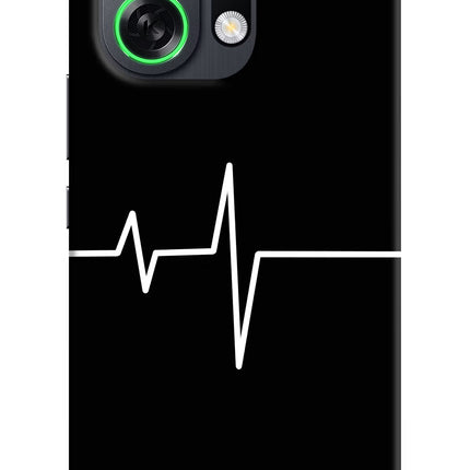 Heart Beats OPPO K13 Turbo Pro 5G Back Cover