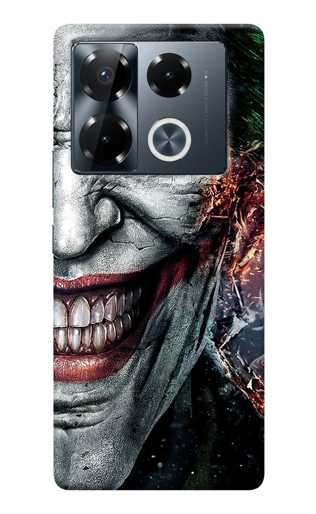 Save Big: Get the Monkey Headphone Infinix Note 40 Pro 5G Back Cover ...