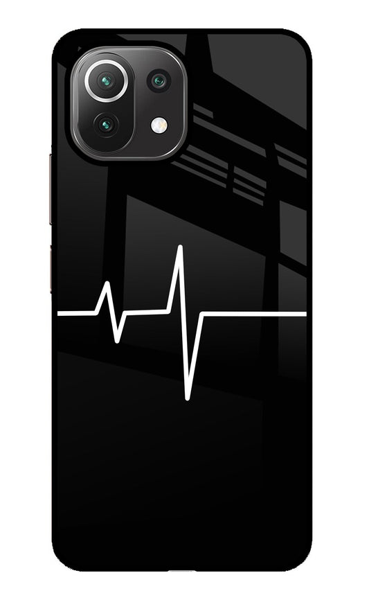Heart Beats Mi 11 Lite Glass Case