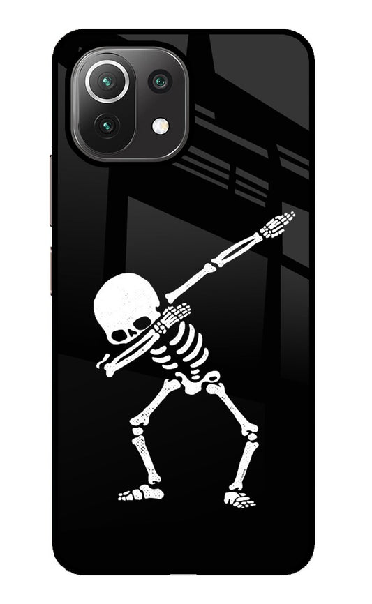 Dabbing Skeleton Art Mi 11 Lite Glass Case