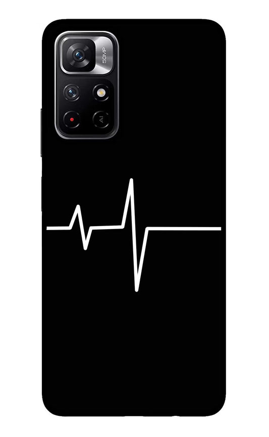 Heart Beats Redmi Note 11T 5G Glass Case