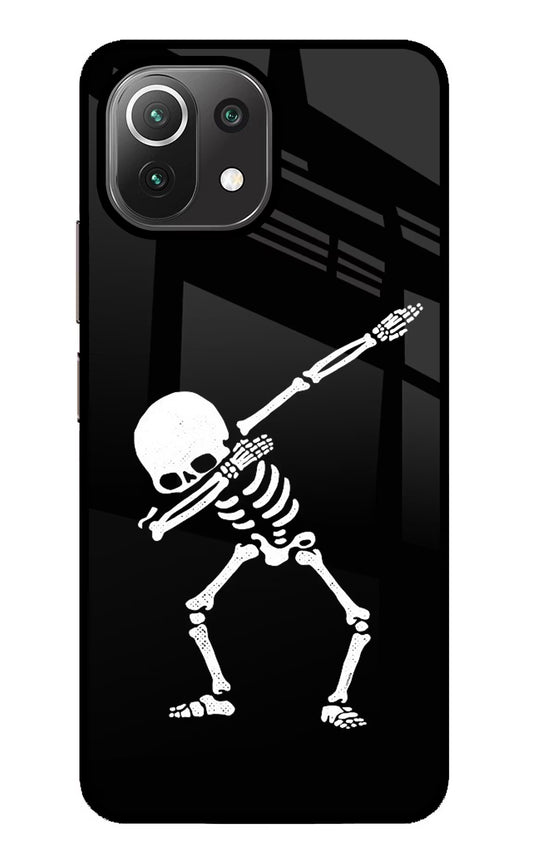 Dabbing Skeleton Art Mi 11 Lite NE 5G Glass Case