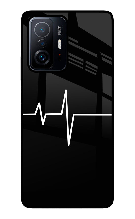 Heart Beats Mi 11T Pro 5G Glass Case