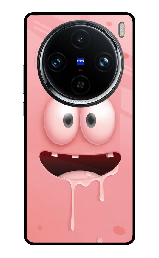 Sponge 2 Vivo X100 Pro Glass Case