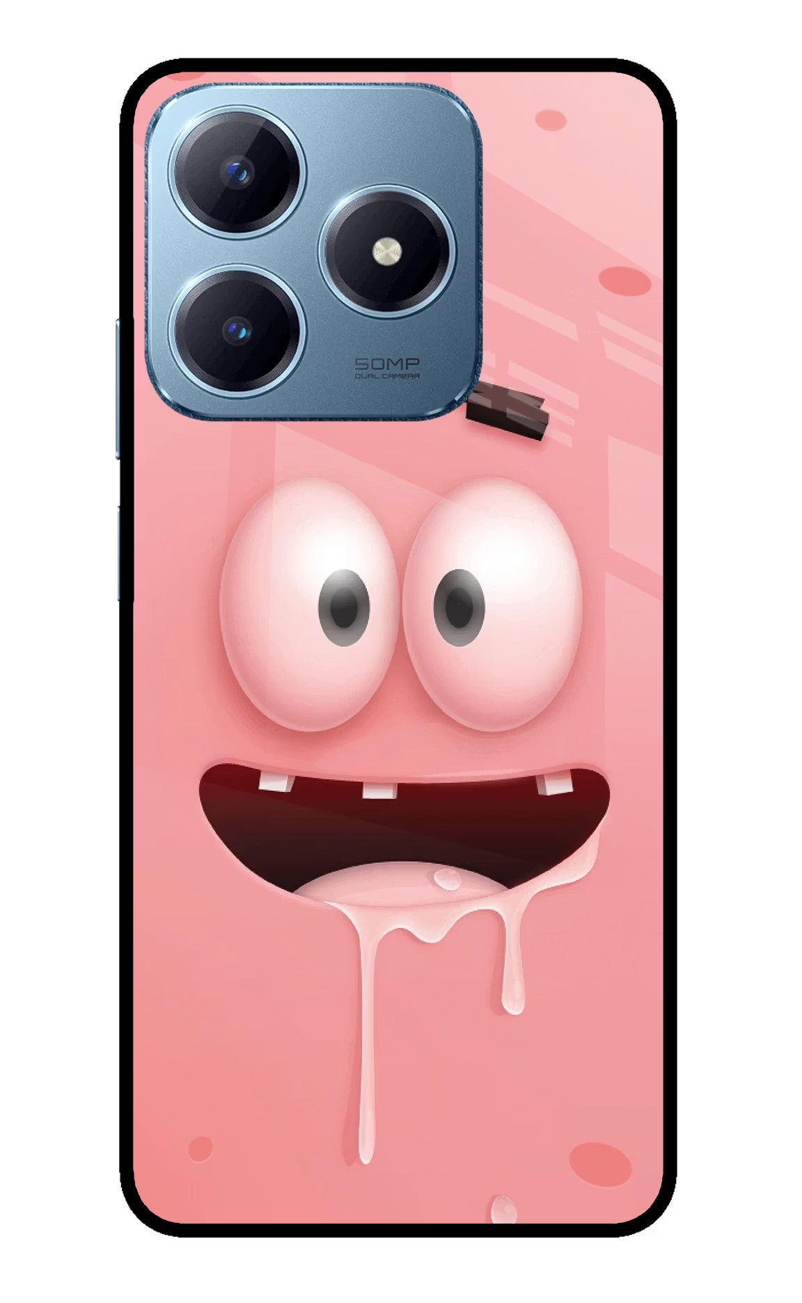 Sponge 2 Realme Narzo N63 Glass Case