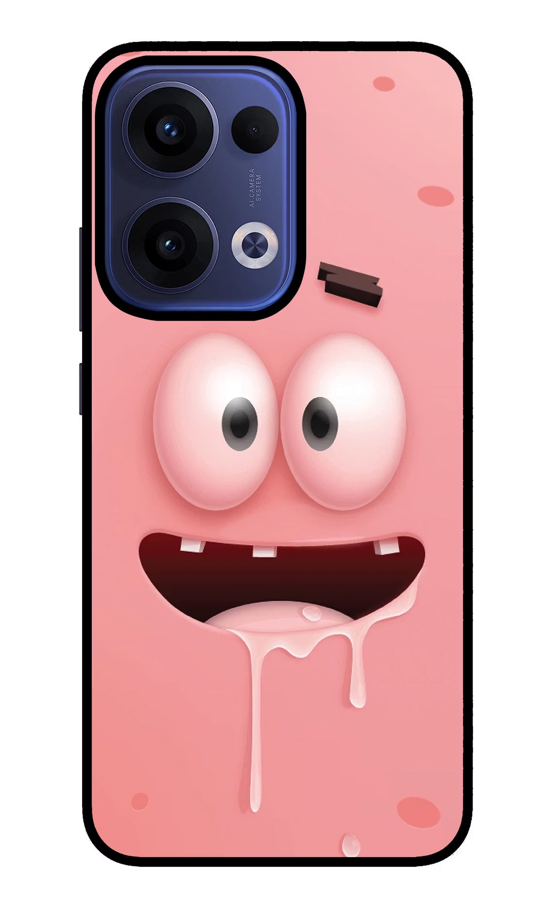 Sponge 2 Oppo Reno13 5G Glass Case Back Cover by Casekaro