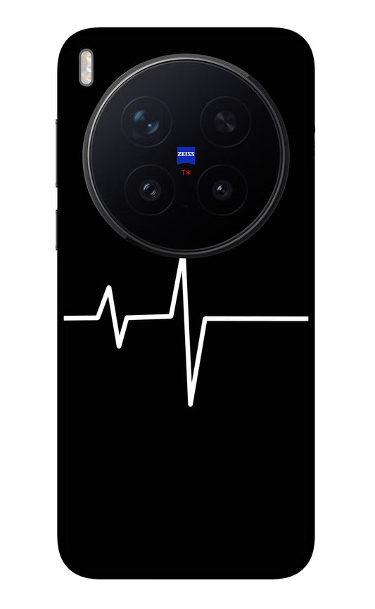 Heart Beats Vivo X300 Pro Glass Case