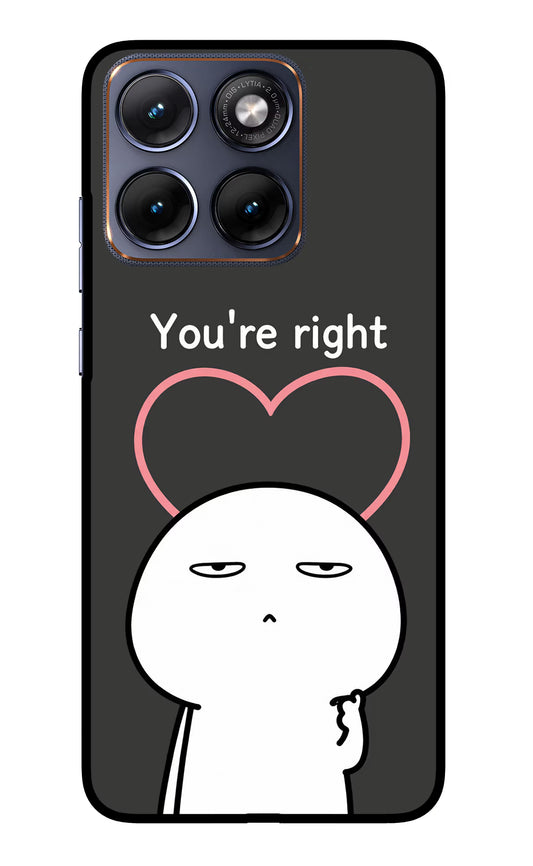You're Right Moto Edge 70 Fusion Glass Case