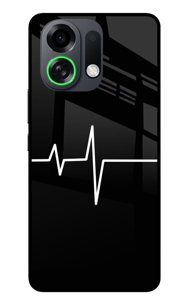 Heart Beats OPPO K13 Turbo Pro 5G Metal Case Back Cover by Casekaro