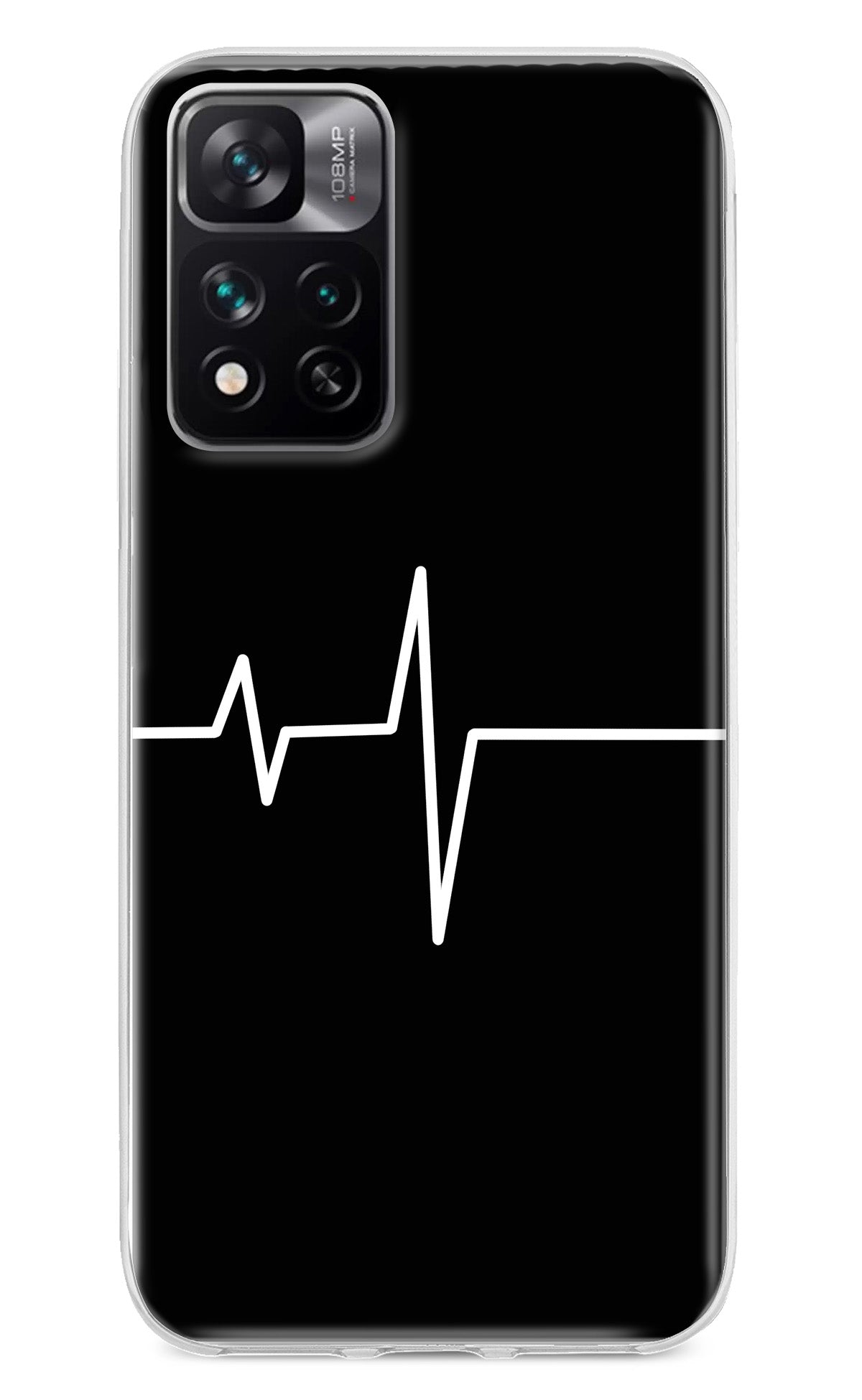 Heart Beats Mi 11i 5G/11i 5G Hypercharge Back Cover