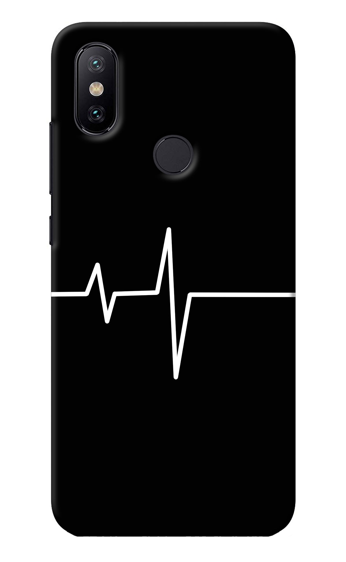 Heart Beats Mi A2 Back Cover