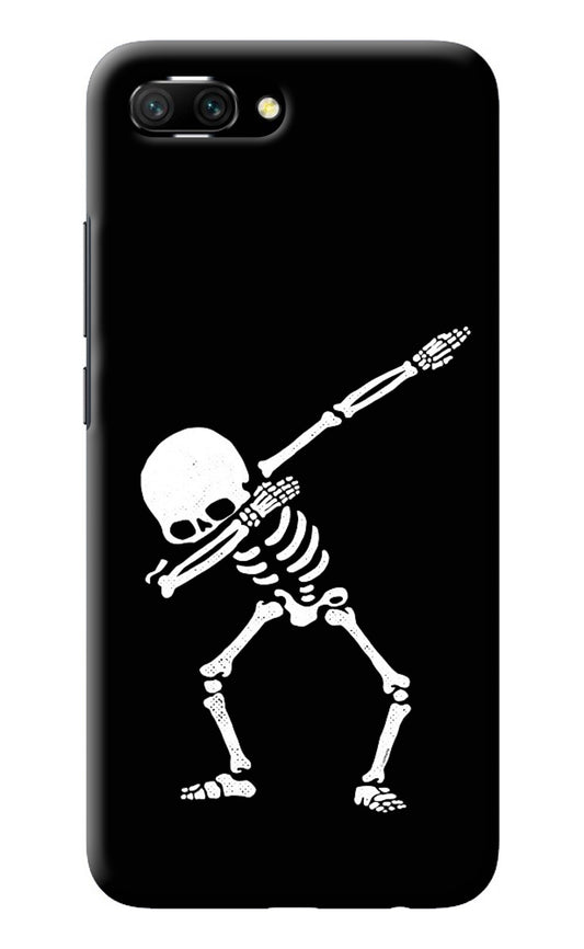 Dabbing Skeleton Art Honor 10 Back Cover