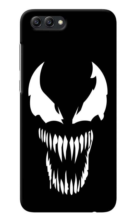 Venom Honor View 10 Back Cover