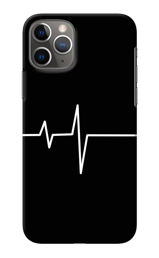 Heart Beats iPhone 11 Pro Back Cover