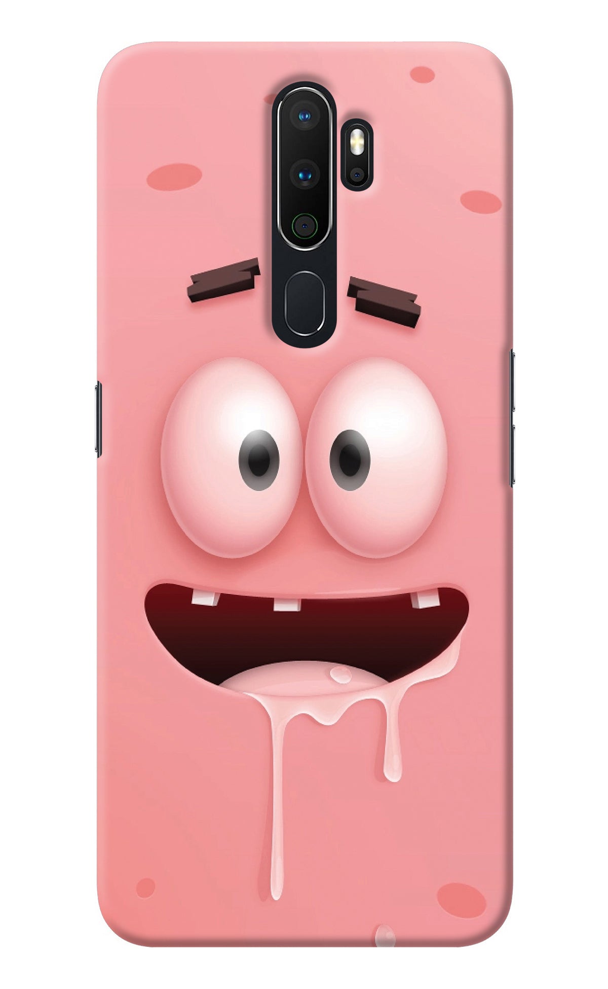 Sponge 2 Oppo A5 2020/A9 2020 Back Cover