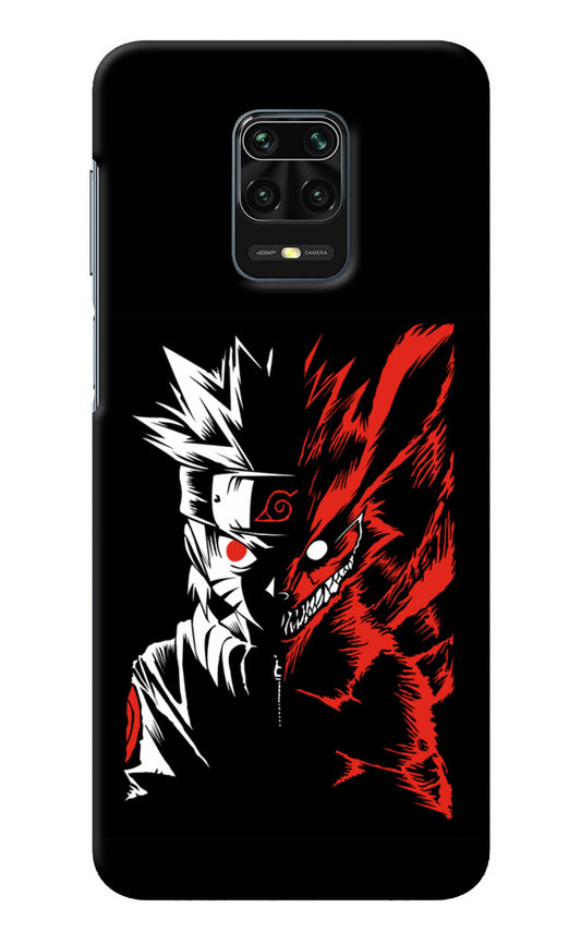 Naruto Two Face Redmi Note 9 Pro/Pro Max Back Cover