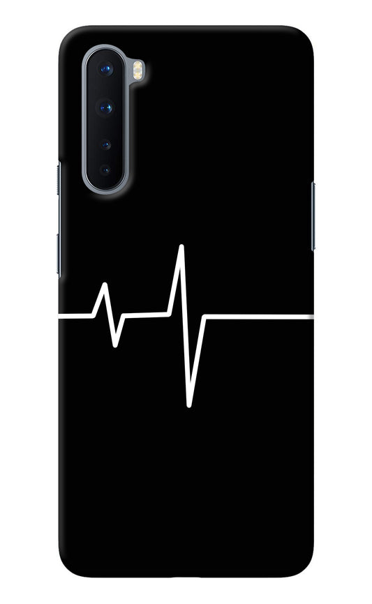 Heart Beats Oneplus Nord Back Cover