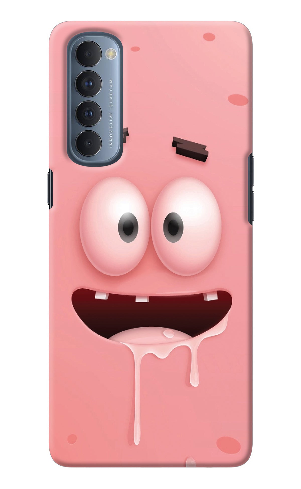 Sponge 2 Oppo Reno4 Pro Back Cover