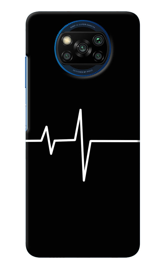 Heart Beats Poco X3/X3 Pro Back Cover