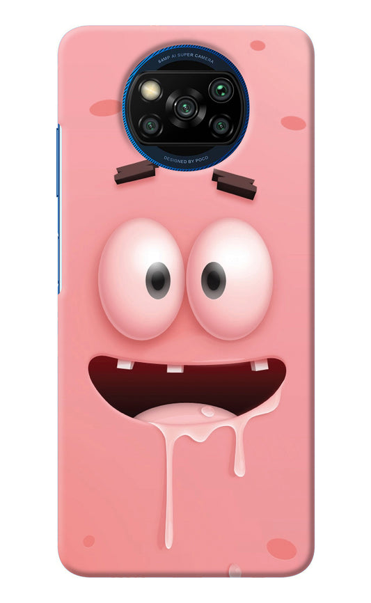 Sponge 2 Poco X3/X3 Pro Back Cover