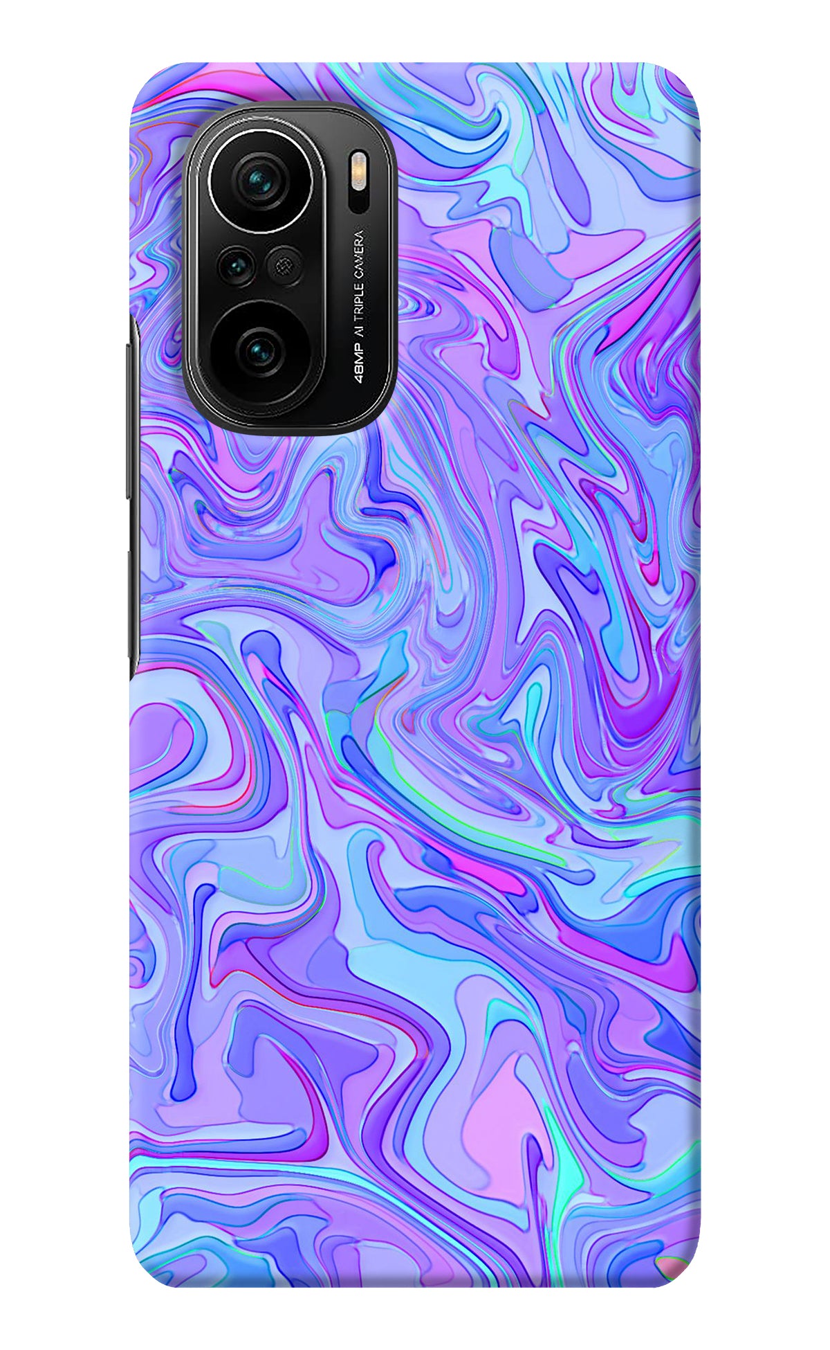 Glitter Mi 11X/11X Pro Back Cover