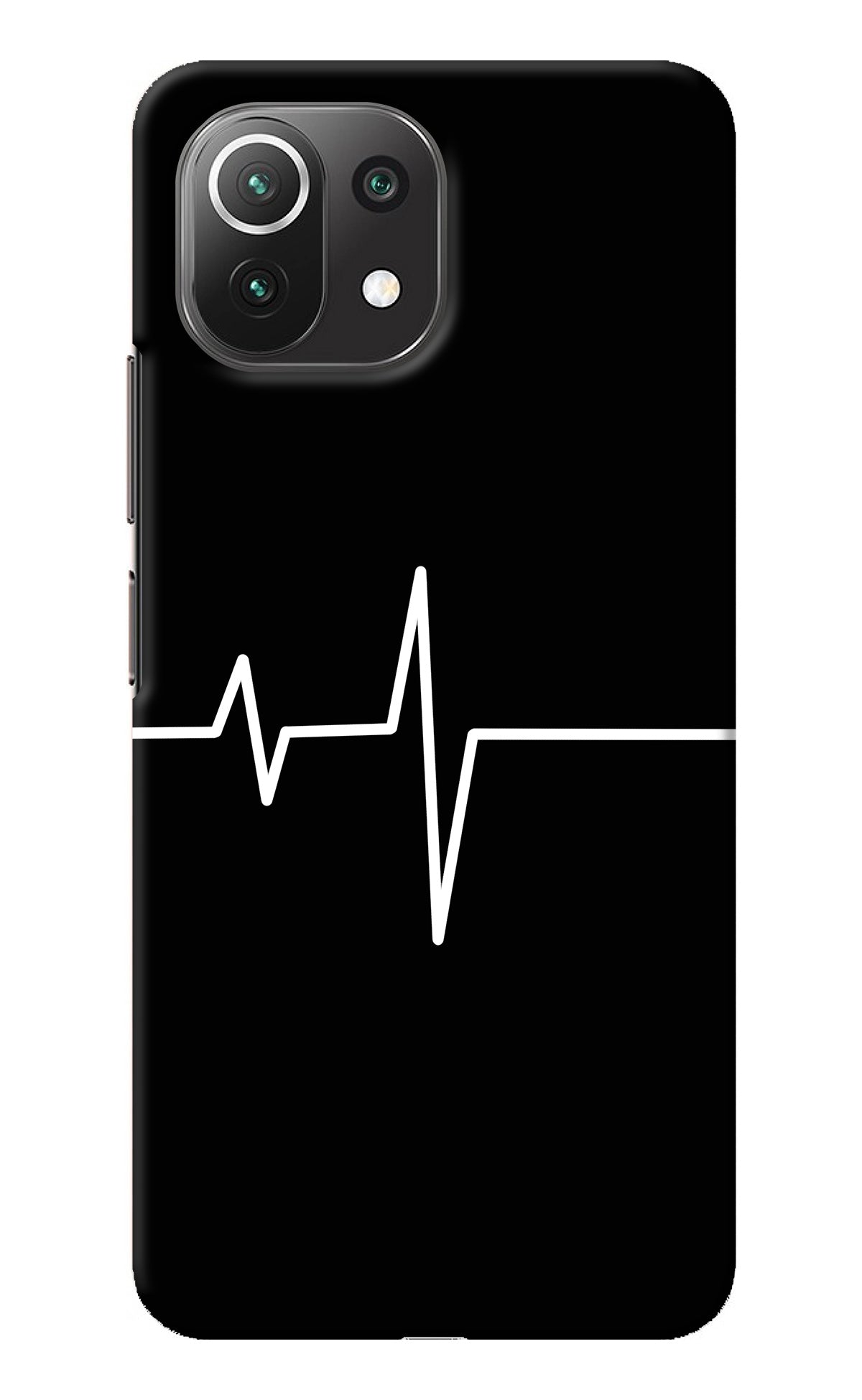 Heart Beats Mi 11 Lite Back Cover