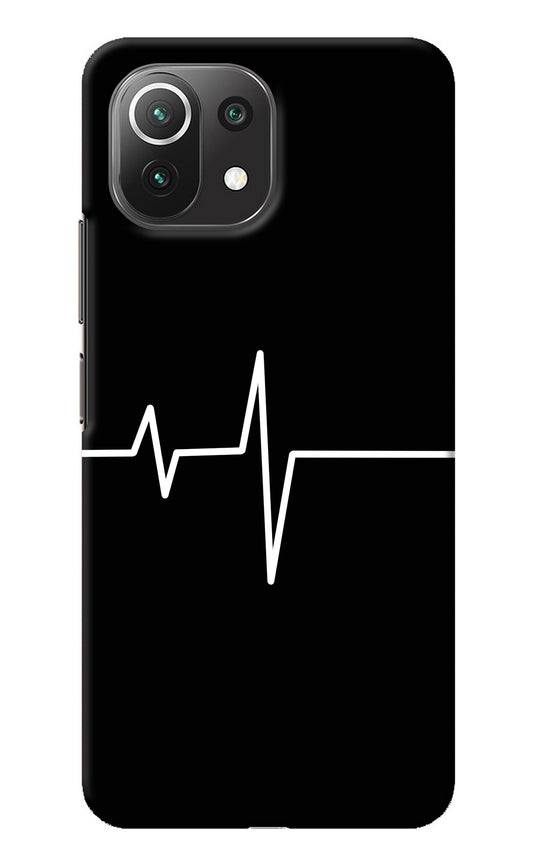 Heart Beats Mi 11 Lite Back Cover