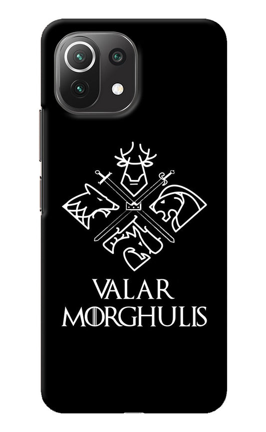 Valar Morghulis | Game Of Thrones Mi 11 Lite Back Cover