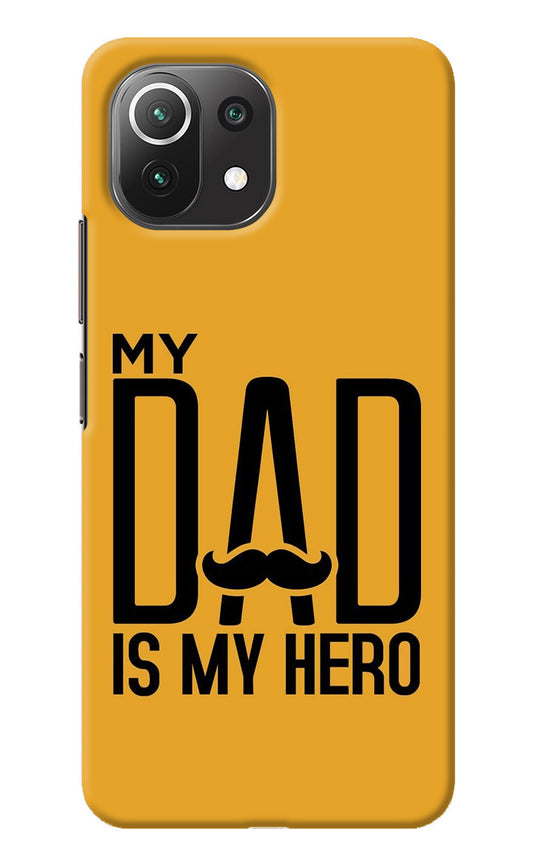 My Dad Is My Hero Mi 11 Lite Back Cover