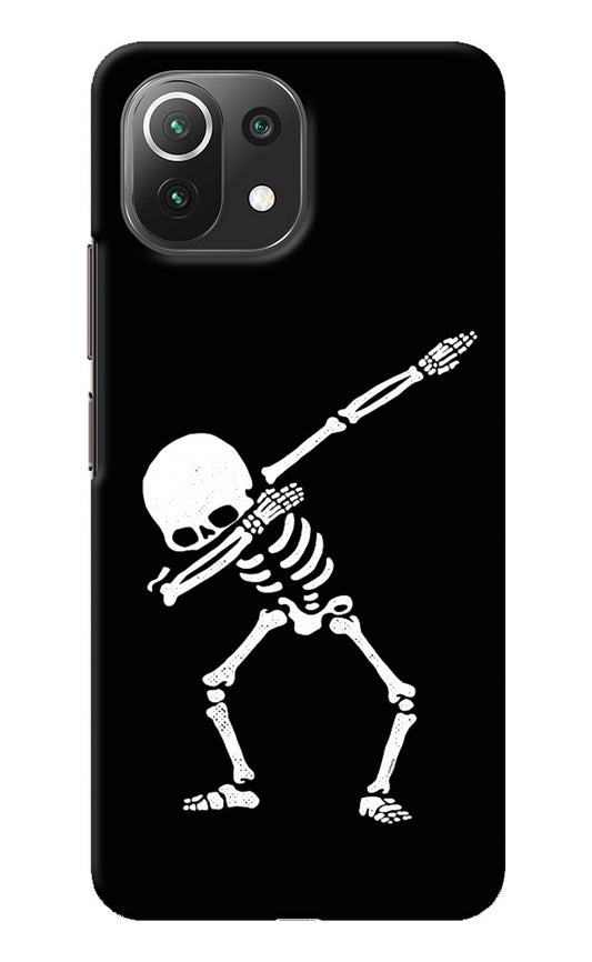 Dabbing Skeleton Art Mi 11 Lite Back Cover