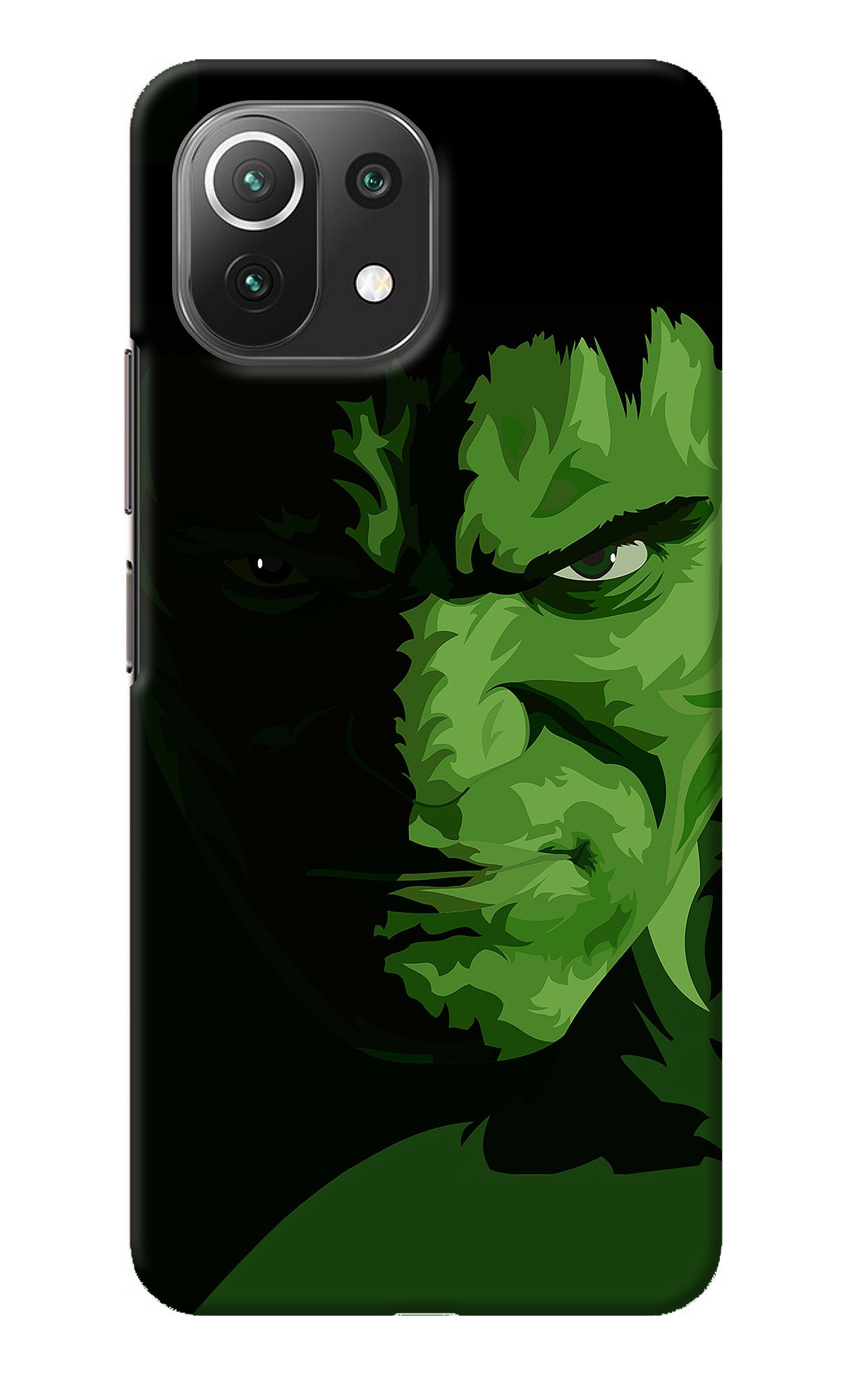 HULK Mi 11 Lite Back Cover